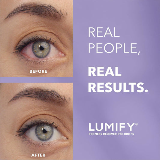Lumify Eye Drops 2.5ml – Fast Acting Eye Brightening Drops, Long Lasting Formula
