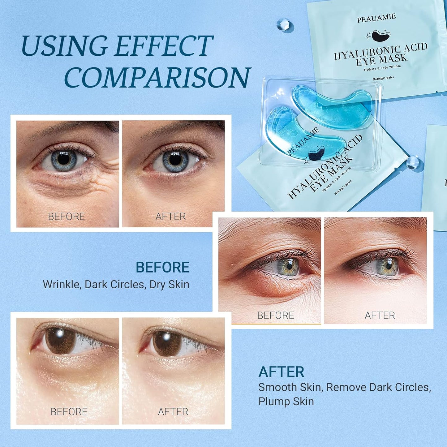 PEAUAMIE Hyaluronic Acid Under Eye Patches for Dark Circles 30 Pairs