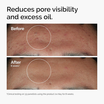 The Ordinary Niacinamide 10% Zinc 1% Face Serum 30 mL