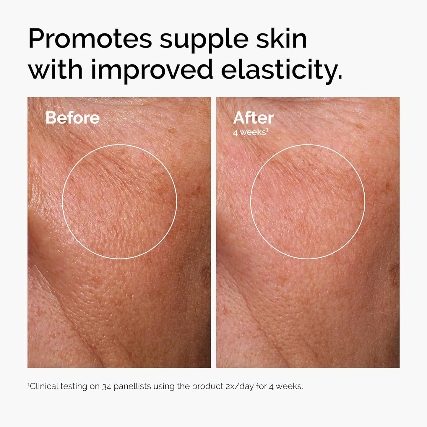 The Ordinary Serum Set Hyaluronic Acid 2% B5 Niacinamide 10% Zinc 1% Caffeine Solution 5%
