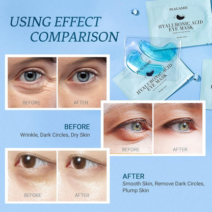 PEAUAMIE Hyaluronic Acid Under Eye Patches for Dark Circles 30 Pairs