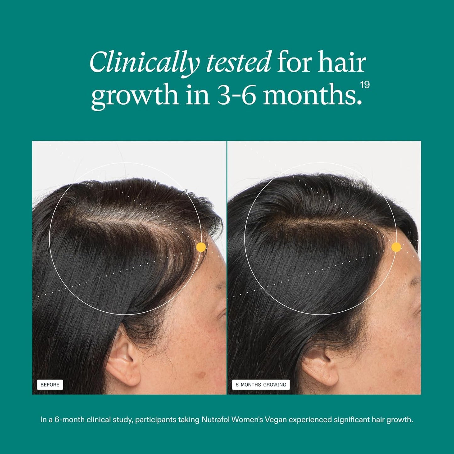 Nutrafol Women’s Hair Growth Supplement Vegan Capsules 1 Month Supply