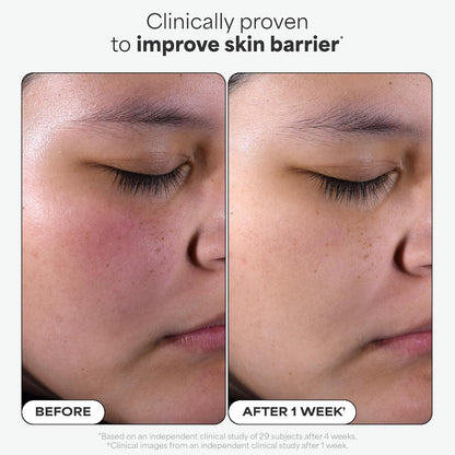 Paula’s Choice Skin Perfecting 2% BHA Liquid Exfoliant – Salicylic Acid, Fragrance-Free, 118 ml