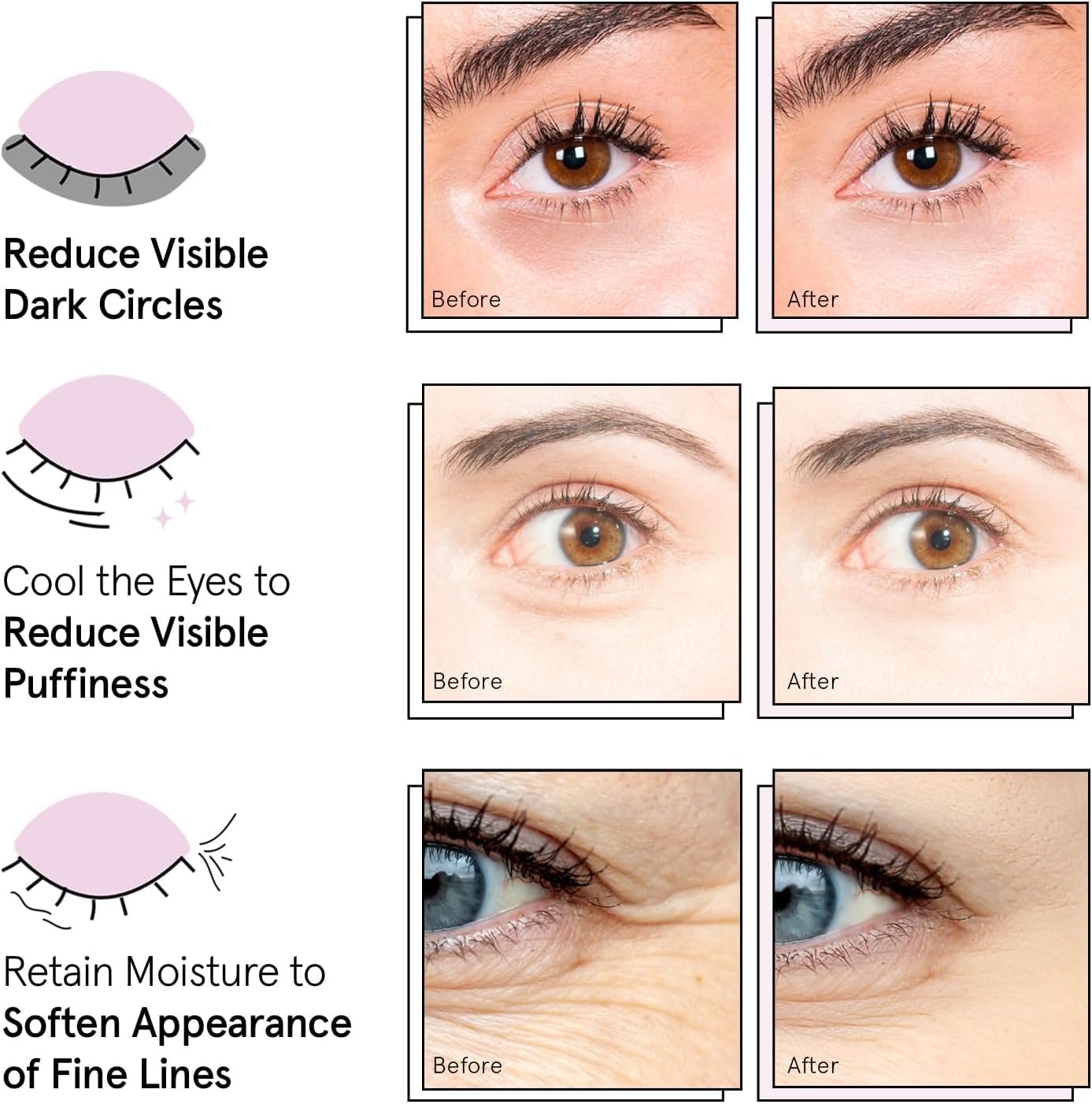 grace & stella Vegan Under Eye Patches for Dark Circles & Puffy Eyes 12 Pairs