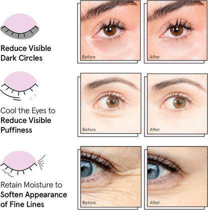 grace & stella Vegan Under Eye Patches for Dark Circles & Puffy Eyes 12 Pairs